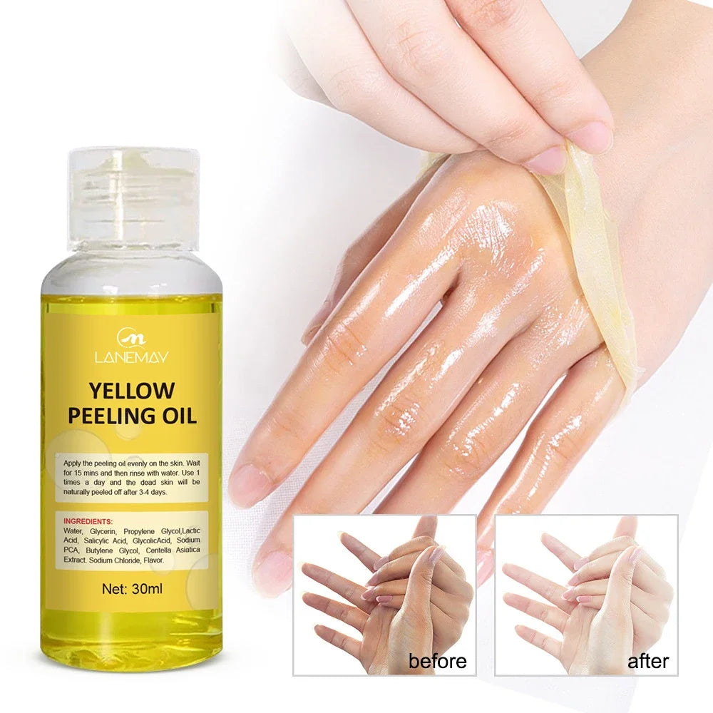 Yellow Peeling Oil Dark Skin Bleaching Remove Arm Knee Legs Melanin Body Brighten Scrub Whiten Exfoliating Dead Skin Care Serum