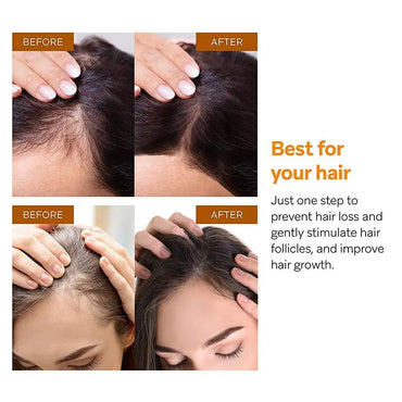 Natural Hair Care Products Natural Anti Alopecia Prevention Alopecia Treatment Rapid Growth Nutrition Dry Damaged Hair Care