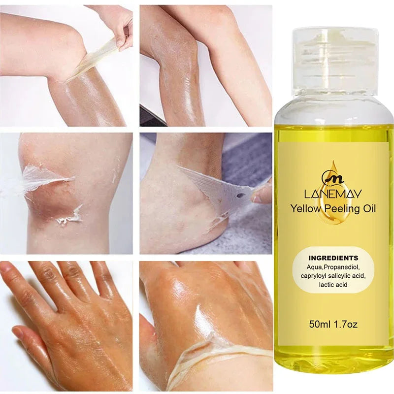 Yellow Peeling Oil Dark Skin Bleaching Remove Arm Knee Legs Melanin Body Brighten Scrub Whiten Exfoliating Dead Skin Care Serum