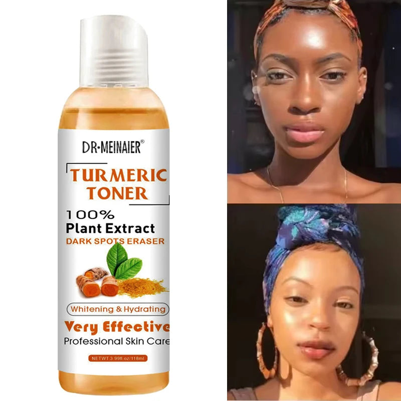 Turmeric Toner Brightening Face Serum Dark Corrector Whitening Serum Moisturizing Vitamin C Ginger Essence Korean Cosmetics