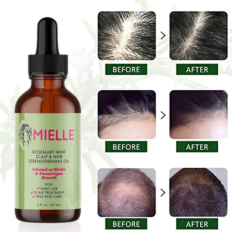 Mielle Rosemary Mint Strong Hair Care Essential Oil 59ml Hair Care Growth Nourishing Hair Strengthening Treatment for Dry Hair