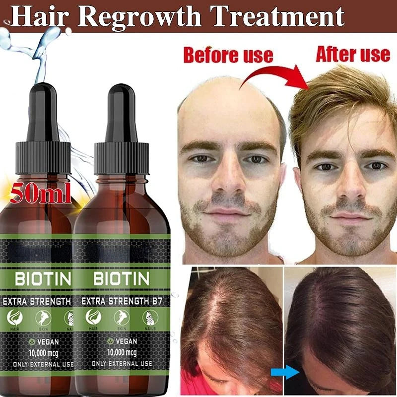 Natural Hair Care Products Natural Anti Alopecia Prevention Alopecia Treatment Rapid Growth Nutrition Dry Damaged Hair Care